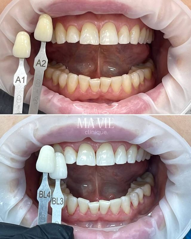 ������ ����: ����� ��� ������ ������������ ��������