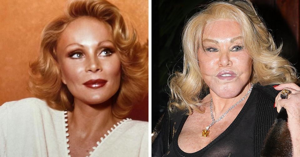 Когда стремление к идеалу убивает: печальные истории жертв пластической хирургии