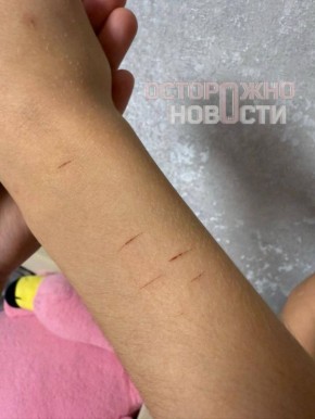 В Омске разыскивают мужчину, изрезавшего лицо 11летней девочки