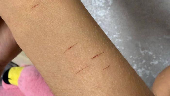 Никто не бил: полиция опровергла нападение на 11-летнюю школьницу в Омске