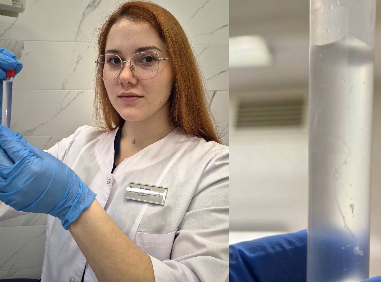 Омские офтальмологи извлекли живого червя из глаза пациентки