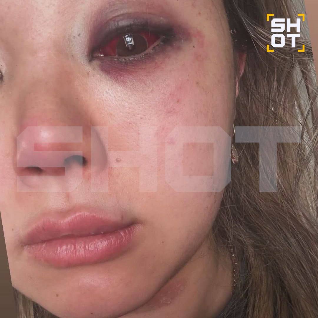 В Омске боксер избил супругу в день годовщины свадьбы В Омске боксер избил супругу в день годовщины свадьбы