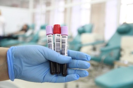 В Омской области продолжают снижаться новые случаи ВИЧ