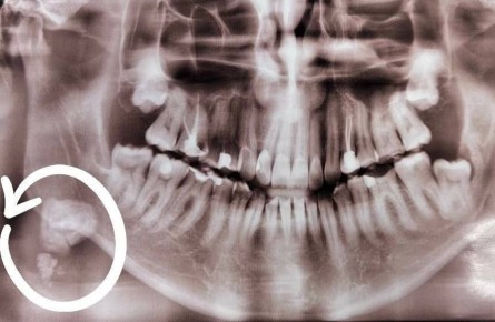 ����� ������� ������ ������ �������� � ������